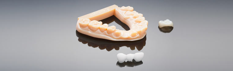 Come la stampa 3d ha cambiato la produzione degli impianti odontoiatrici