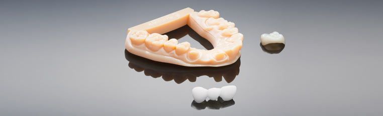 Come la stampa 3d ha cambiato la produzione degli impianti odontoiatrici